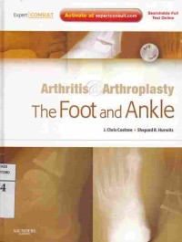 Arthritis & Arthroplasty : The Foot and Ankle