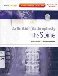 Arthritis & Arthroplasty : The Spine